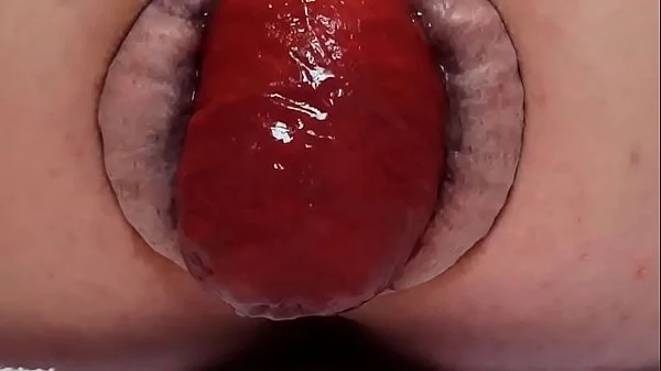 Contender For Biggest Prolapse (Male Warning!)